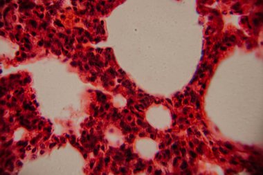 Tarihsel görüntü kemik iliği dokusunu kırmızı lekeli hematopoetik hücreler ve yüksek büyütmede görünen beyaz yağ bölgeleriyle gösteriyor..