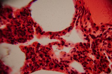 Tarihsel görüntü kemik iliği dokusunu kırmızı lekeli hematopoetik hücreler ve yüksek büyütmede görünen beyaz yağ bölgeleriyle gösteriyor..