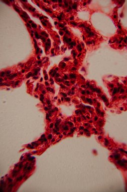 Tarihsel görüntü kemik iliği dokusunu kırmızı lekeli hematopoetik hücreler ve yüksek büyütmede görünen beyaz yağ bölgeleriyle gösteriyor..