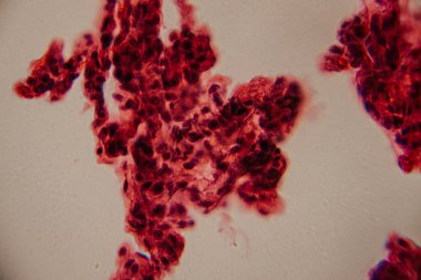 Tarihsel görüntü kemik iliği dokusunu kırmızı lekeli hematopoetik hücreler ve yüksek büyütmede görünen beyaz yağ bölgeleriyle gösteriyor..