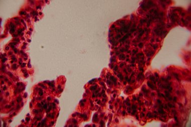 Tarihsel görüntü kemik iliği dokusunu kırmızı lekeli hematopoetik hücreler ve yüksek büyütmede görünen beyaz yağ bölgeleriyle gösteriyor..