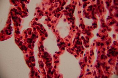 Tarihsel görüntü kemik iliği dokusunu kırmızı lekeli hematopoetik hücreler ve yüksek büyütmede görünen beyaz yağ bölgeleriyle gösteriyor..