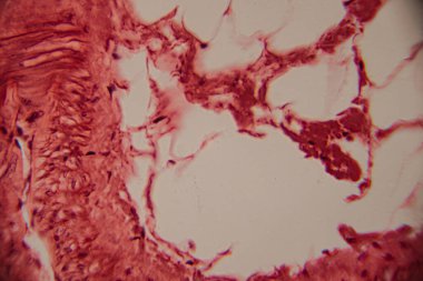 İnsan adipoz dokusunun histolojik bir görüntüsü, büyük, soluk yağ hücreleri (adipokitler) ve yüksek büyütmede kırmızı lekeli hücre zarları göstermektedir..