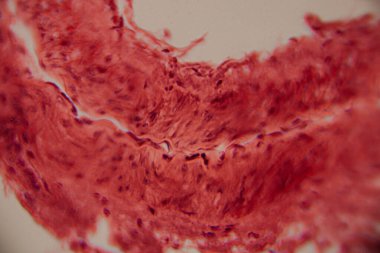 Tarihsel görüntü kemik iliği dokusunu kırmızı lekeli hematopoetik hücreler ve yüksek büyütmede görünen beyaz yağ bölgeleriyle gösteriyor..