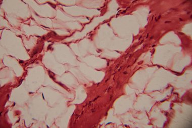 İnsan adipoz dokusunun histolojik bir görüntüsü, büyük, soluk yağ hücreleri (adipokitler) ve yüksek büyütmede kırmızı lekeli hücre zarları göstermektedir..