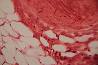 Tarihsel görüntü kemik iliği dokusunu kırmızı lekeli hematopoetik hücreler ve yüksek büyütmede görünen beyaz yağ bölgeleriyle gösteriyor..