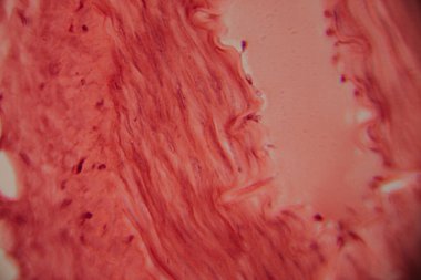 Tarihsel görüntü kemik iliği dokusunu kırmızı lekeli hematopoetik hücreler ve yüksek büyütmede görünen beyaz yağ bölgeleriyle gösteriyor..