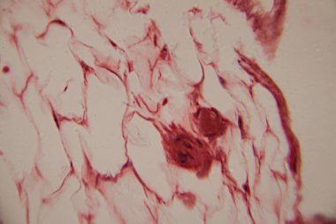 İnsan adipoz dokusunun histolojik bir görüntüsü, büyük, soluk yağ hücreleri (adipokitler) ve yüksek büyütmede kırmızı lekeli hücre zarları göstermektedir..