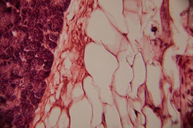 Adipoz doku hücrelerinin mikroskobik görüntüsü pembe lekeli histoloji bölümünde büyük lipit damlacıklar ve hücre zarları gösteriyor..