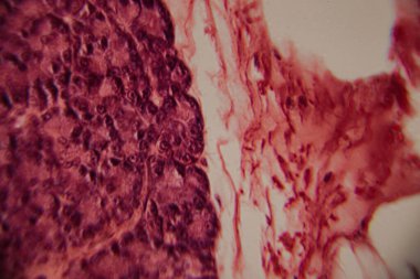 Adipoz doku hücrelerinin mikroskobik görüntüsü pembe lekeli histoloji bölümünde büyük lipit damlacıklar ve hücre zarları gösteriyor..