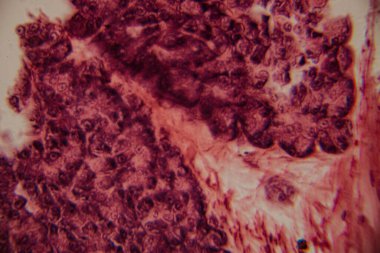 Beyaz adipoz dokusu ve kırmızı kemik iliği arasındaki geçişi gösteren mikroskobik görüntü yağ hücrelerini ve yoğun paketlenmiş hematopoetik hücreleri vurguluyor..