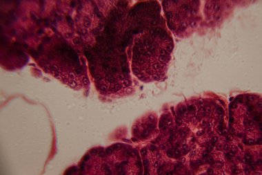 Beyaz adipoz dokusu ve kırmızı kemik iliği arasındaki geçişi gösteren mikroskobik görüntü yağ hücrelerini ve yoğun paketlenmiş hematopoetik hücreleri vurguluyor..