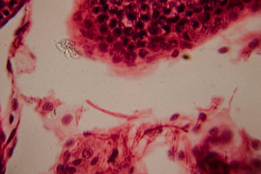 Beyaz adipoz dokusu ve kırmızı kemik iliği arasındaki geçişi gösteren mikroskobik görüntü yağ hücrelerini ve yoğun paketlenmiş hematopoetik hücreleri vurguluyor..