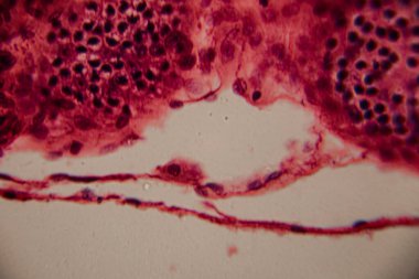 Beyaz adipoz dokusu ve kırmızı kemik iliği arasındaki geçişi gösteren mikroskobik görüntü yağ hücrelerini ve yoğun paketlenmiş hematopoetik hücreleri vurguluyor..