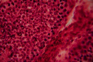 Bir insan atardamarının mikroskobik görüntüsü, kan damarının lümenini, pürüzsüz kas katmanlarını ve çevreleyen dokuyu gösteriyor. Pembe ve kırmızı leke.