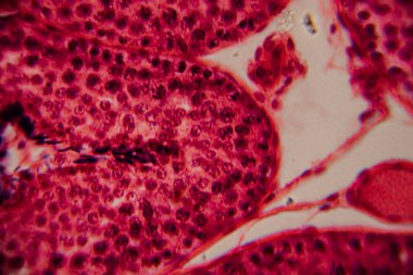 Bir insan atardamarının mikroskobik görüntüsü, kan damarının lümenini, pürüzsüz kas katmanlarını ve çevreleyen dokuyu gösteriyor. Pembe ve kırmızı leke.