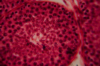 Bir insan atardamarının mikroskobik görüntüsü, kan damarının lümenini, pürüzsüz kas katmanlarını ve çevreleyen dokuyu gösteriyor. Pembe ve kırmızı leke.