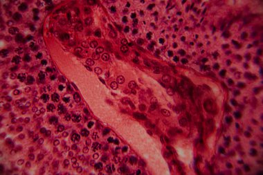 Bir insan atardamarının mikroskobik görüntüsü, kan damarının lümenini, pürüzsüz kas katmanlarını ve çevreleyen dokuyu gösteriyor. Pembe ve kırmızı leke.