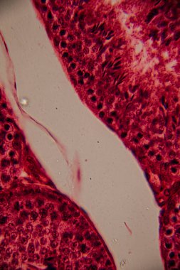 Bir insan atardamarının mikroskobik görüntüsü, kan damarının lümenini, pürüzsüz kas katmanlarını ve çevreleyen dokuyu gösteriyor. Pembe ve kırmızı leke.