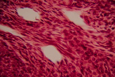 Memelilerin yumurtalıklarının mikroskobik görüntüsü açık bir şekilde büyüyen folikül ve çevresindeki foliküler hücreler pembe ve kırmızı tonlarda boyanmış..