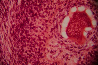 Memelilerin yumurtalıklarının mikroskobik görüntüsü açık bir şekilde büyüyen folikül ve çevresindeki foliküler hücreler pembe ve kırmızı tonlarda boyanmış..