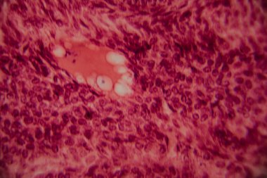 Memelilerin yumurtalıklarının mikroskobik görüntüsü açık bir şekilde büyüyen folikül ve çevresindeki foliküler hücreler pembe ve kırmızı tonlarda boyanmış..