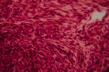 Memelilerin yumurtalıklarının mikroskobik görüntüsü açık bir şekilde büyüyen folikül ve çevresindeki foliküler hücreler pembe ve kırmızı tonlarda boyanmış..