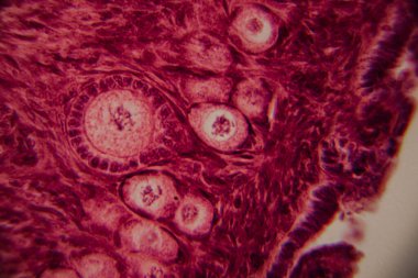 Memelilerin yumurtalıklarının mikroskobik görüntüsü açık bir şekilde büyüyen folikül ve çevresindeki foliküler hücreler pembe ve kırmızı tonlarda boyanmış..