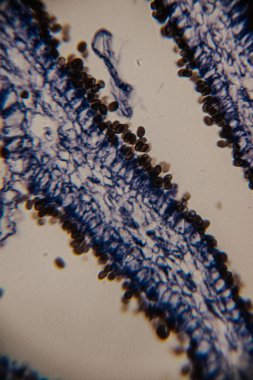 Yaprak dokusunun mikroskobik görüntüsü epidermal hücreleri ve koyu mavi renkte olası solungaç yapıları gösteriyor. Açık renk arkaplan ve net hücresel detaylar..