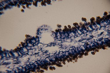 Yaprak dokusunun mikroskobik görüntüsü epidermal hücreleri ve koyu mavi renkte olası solungaç yapıları gösteriyor. Açık renk arkaplan ve net hücresel detaylar..