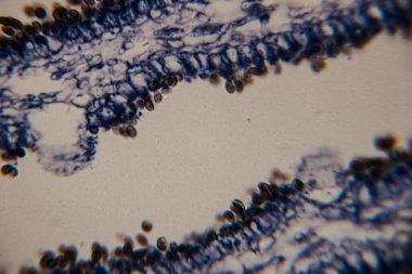 Yaprak dokusunun mikroskobik görüntüsü epidermal hücreleri ve koyu mavi renkte olası solungaç yapıları gösteriyor. Açık renk arkaplan ve net hücresel detaylar..