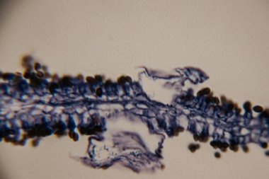 Yaprak dokusunun mikroskobik görüntüsü epidermal hücreleri ve koyu mavi renkte olası solungaç yapıları gösteriyor. Açık renk arkaplan ve net hücresel detaylar..