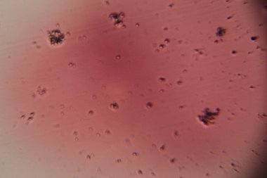 Mikroskobik görüntü hücre bölünmesi sırasında görünür koyu kromozomlarla pembeye boyanmış soğan kökü uçlu hücrelerde mitozun çeşitli evrelerini gösteriyor..