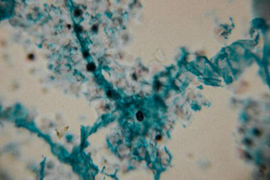 Mikroskobik görüntü koyu çekirdekli yoğun bir mavi lekeli hücre kümesini gösteriyor, bitki ya da mantar dokusuna işaret ediyor. Bazı yerlerde, kopyada bir nokta görülebilir..