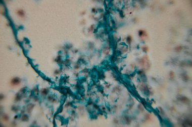 Mikroskobik görüntü koyu çekirdekli yoğun bir mavi lekeli hücre kümesini gösteriyor, bitki ya da mantar dokusuna işaret ediyor. Bazı yerlerde, kopyada bir nokta görülebilir..