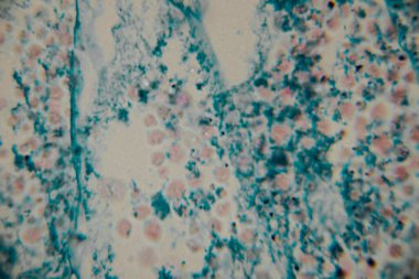 Mikroskobik görüntü koyu çekirdekli yoğun bir mavi lekeli hücre kümesini gösteriyor, bitki ya da mantar dokusuna işaret ediyor. Bazı yerlerde, kopyada bir nokta görülebilir..