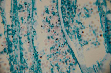 Mikroskobik görüntü koyu çekirdekli yoğun bir mavi lekeli hücre kümesini gösteriyor, bitki ya da mantar dokusuna işaret ediyor. Bazı yerlerde, kopyada bir nokta görülebilir..