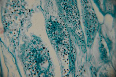 Mikroskobik görüntü koyu çekirdekli yoğun bir mavi lekeli hücre kümesini gösteriyor, bitki ya da mantar dokusuna işaret ediyor. Bazı yerlerde, kopyada bir nokta görülebilir..