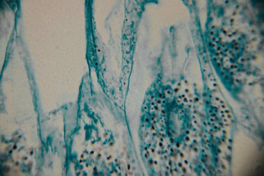 Mikroskobik görüntü koyu çekirdekli yoğun bir mavi lekeli hücre kümesini gösteriyor, bitki ya da mantar dokusuna işaret ediyor. Bazı yerlerde, kopyada bir nokta görülebilir..