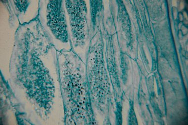 Mikroskobik görüntü koyu çekirdekli yoğun bir mavi lekeli hücre kümesini gösteriyor, bitki ya da mantar dokusuna işaret ediyor. Bazı yerlerde, kopyada bir nokta görülebilir..