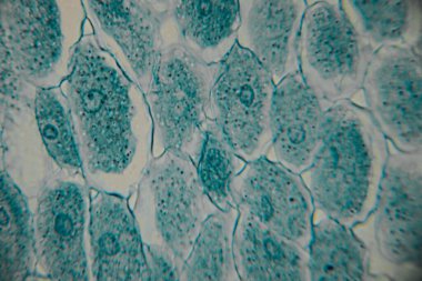 Mavi lekeli çekirdekli bitki hücrelerinin mikroskobik görüntüsü ve altıgen desenli düzenlenmiş hücre duvarları iç hücre yapılarını ortaya çıkarıyor..