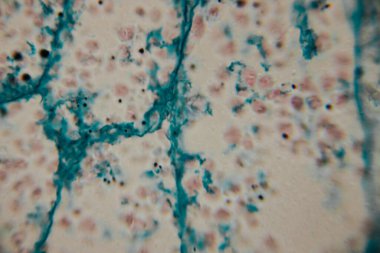 Mavi lekeli hücre duvarlarını gösteren bitki dokusunun büyütülmüş görüntüsü ve hafif pembe ve siyah lekeli hücre yapıları..