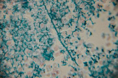 Mavi lekeli hücre duvarlarını gösteren bitki dokusunun büyütülmüş görüntüsü ve hafif pembe ve siyah lekeli hücre yapıları..