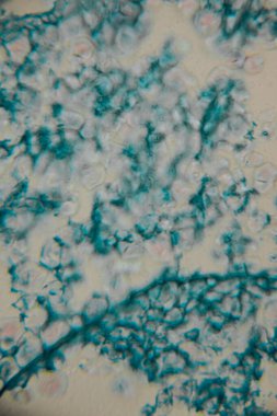 Mavi lekeli hücre duvarlarını gösteren bitki dokusunun büyütülmüş görüntüsü ve hafif pembe ve siyah lekeli hücre yapıları..