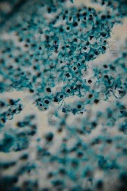 Mavi lekeli hücre duvarlarını gösteren bitki dokusunun büyütülmüş görüntüsü ve hafif pembe ve siyah lekeli hücre yapıları..