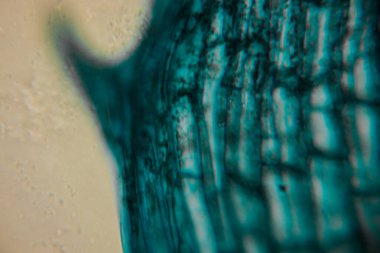 Sivri uçlu bir bitki yaprağının, mavi epidermal hücreleri ve detaylı hücresel yapıyı gösteren yüksek büyütme görüntüsü..