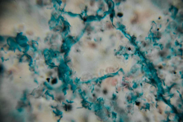 Mikroskobik görüntü koyu çekirdekli yoğun bir mavi lekeli hücre kümesini gösteriyor, bitki ya da mantar dokusuna işaret ediyor. Bazı yerlerde, kopyada bir nokta görülebilir..