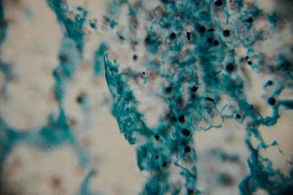 Mikroskobik görüntü koyu çekirdekli yoğun bir mavi lekeli hücre kümesini gösteriyor, bitki ya da mantar dokusuna işaret ediyor. Bazı yerlerde, kopyada bir nokta görülebilir..