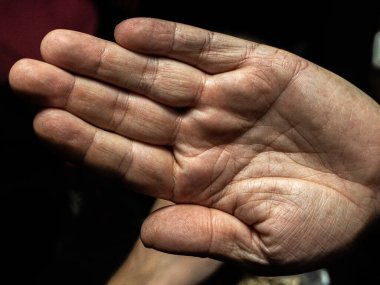 Avuç içi açık, deri dokularını ve çizgilerini gösteren bir insan eli. Koyu bir arka plan üzerine kurulmuş ve elin detaylarını vurguluyor.