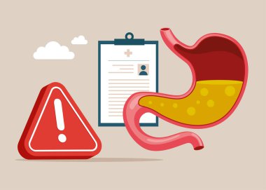 Mide asidi dolu bir insan midesi ünlem işareti ile kesiliyor. Gastroözofagus reflü hastalığı. Sorun var. Düz vektör illüstrasyonu